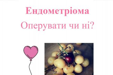 ​Ендометріома: Опирувати чи ні?