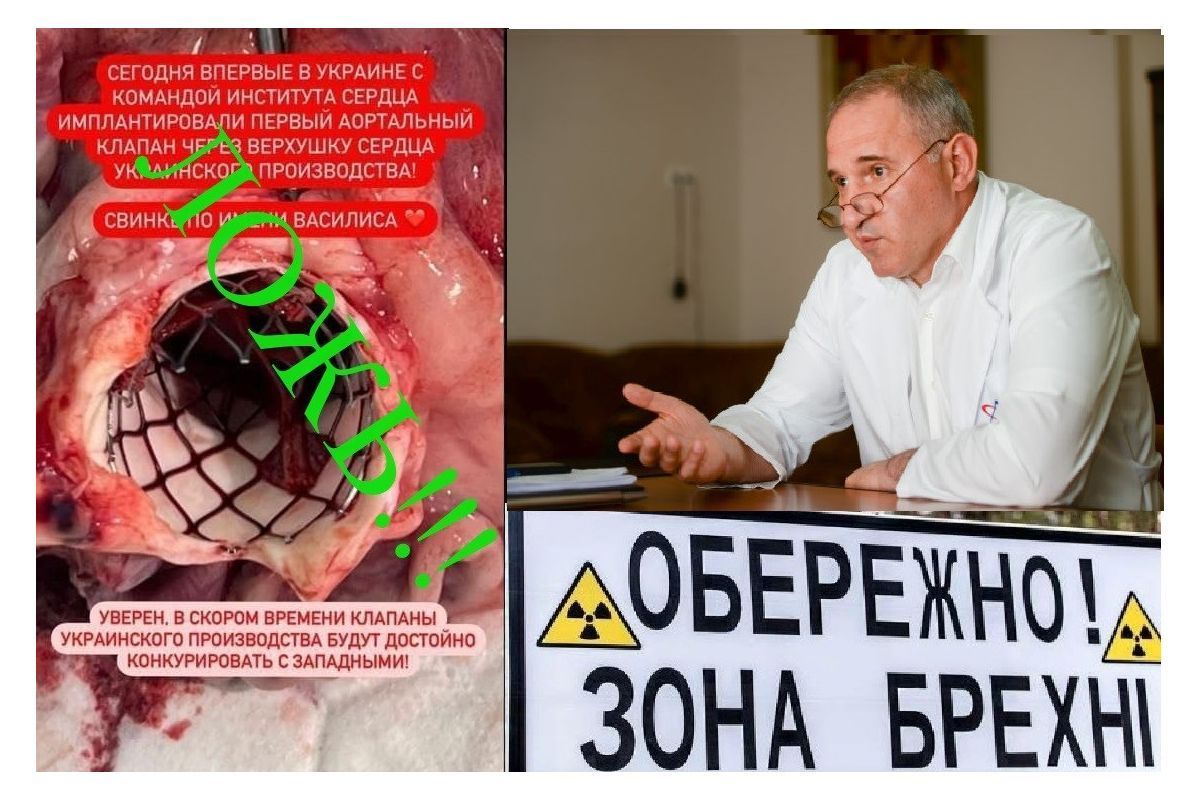 All shrouded in lies? Is that how the Ukrainian cardiac surgery really looks like?